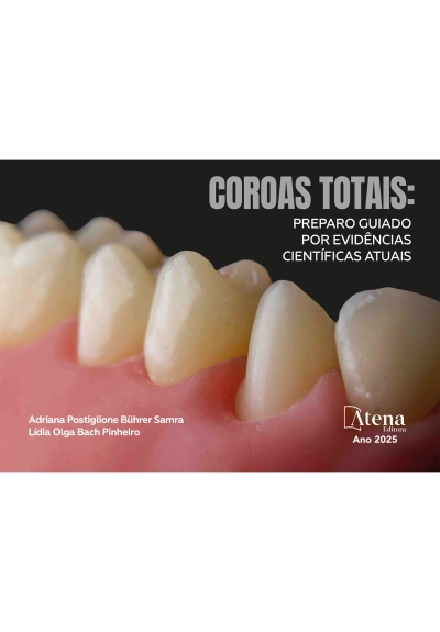 Coroas totais: preparo guiado por evidências científicas atuais
