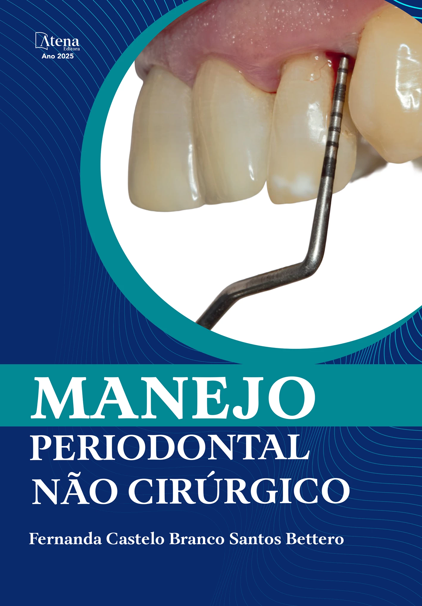 capa do ebook Manejo periodontal não cirúrgico