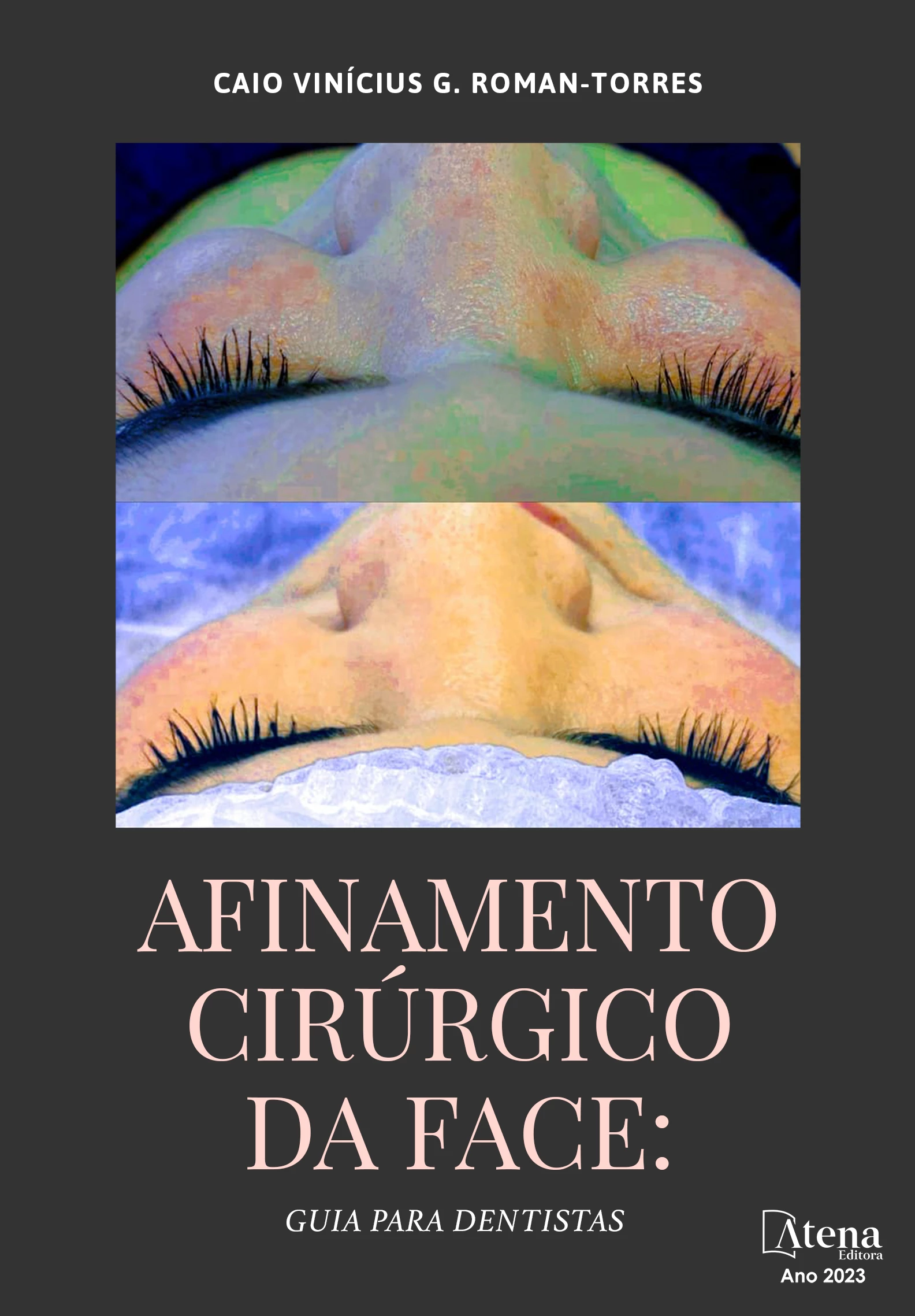 capa do ebook Afinamento cirúrgico da face – Guia para Dentistas