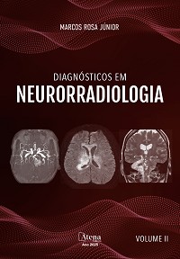 Livros