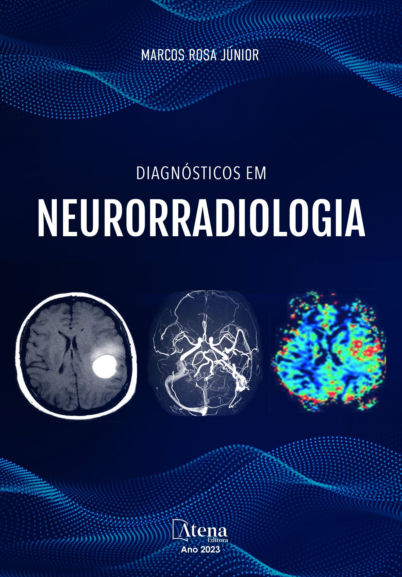Livros